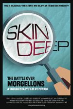 Watch Skin Deep: The Battle Over Morgellons Letmewatchthis