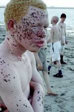 Watch Albino United Letmewatchthis