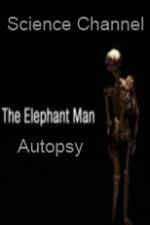 Watch Science Channel Elephant Man Autopsy Letmewatchthis