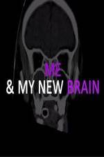 Watch Me & My New Brain Letmewatchthis