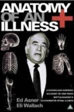 Watch Anatomy of an Illness Letmewatchthis