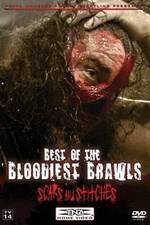 Watch TNA Wrestling: Best of the Bloodiest Brawls - Scars and Stitches Letmewatchthis