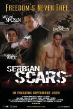 Watch Serbian Scars Letmewatchthis