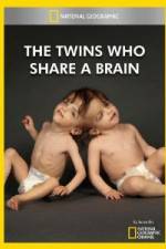 Watch National Geographic The Twins Who Share A Brain Letmewatchthis