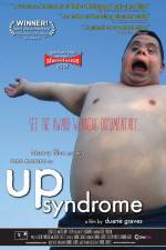 Watch Up Syndrome Letmewatchthis