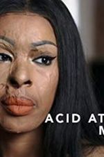 Watch Acid Attack: My Story Letmewatchthis